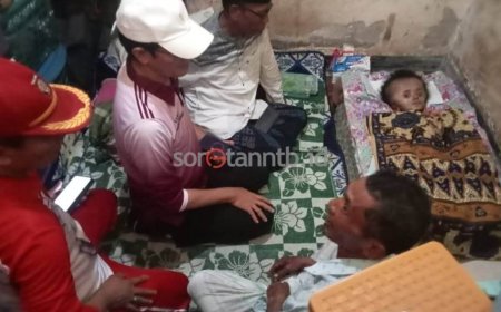 Wabup HM Nursiah Pimpin Intervensi Terpadu, Anak Penderita Hidrosefalus di Kawo Dapat Dukungan Lintas Sektor