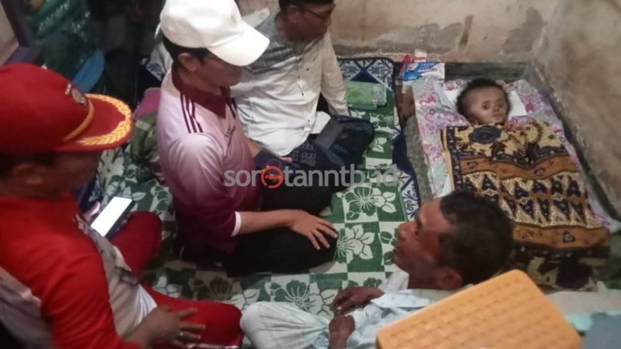 Wabup HM Nursiah Pimpin Intervensi Terpadu, Anak Penderita Hidrosefalus di Kawo Dapat Dukungan Lintas Sektor